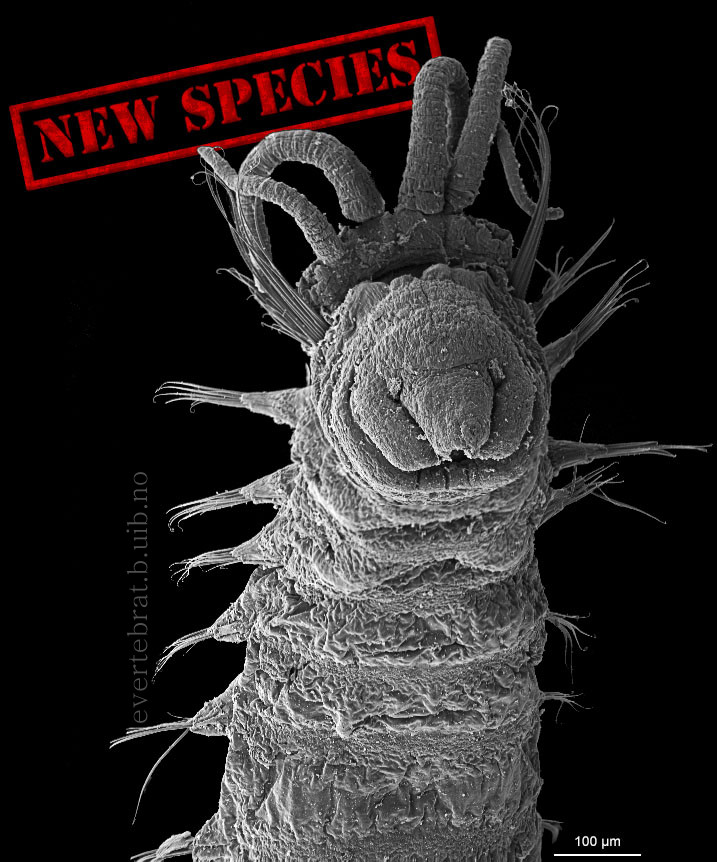 For å beskrive den nye arten har vi brukt ulike teknikker, her er et foto tatt med elektronscanningsmikroskop. Foto: K. Kongshavn