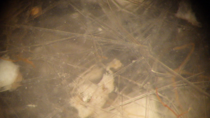 Små, små nåler - spiklene er svampenes "skjelett" og forsvarsmekanisme