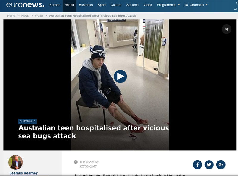 Forsiden på Euronews sin nettside-sak om angrepet på guttens bein. Teksten dekker over mesteparten av skadene, heldigvis?. Foto: Faksimile fra euronews.com